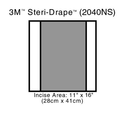 3M™ Steri-Drape™ 2 Inzisionsfolie, 2040NS 28 cm x 41 cm