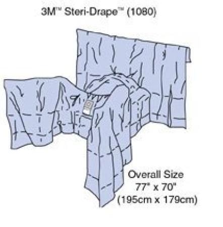 3M™ Steri Drape™ Gynäkologie-Abdeckung, 1080, 195 cm x 179 cm, 14 Stück / Packung