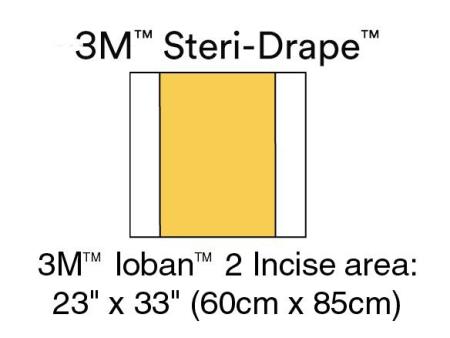 3M™ Ioban™ 2 Antimikrobielle Inzisionsfolie, 6651EU, 56 cm x 85 cm, 10 Stück / Packung