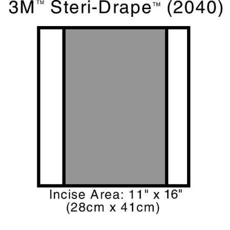 3M™ Steri Drape™ 2, Inzisionsfolie, 2040, Abmessung Inzisionsfeld 28 x 41 cm